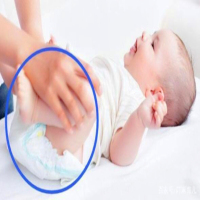 Evite a ação errada de trocar as fraldas do bebê (1)